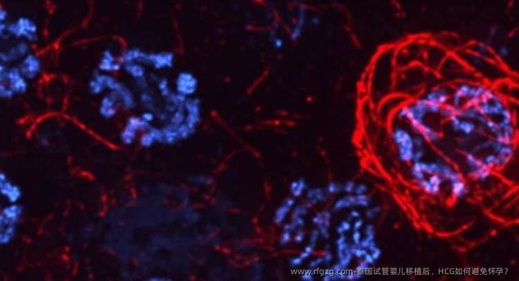 泰国代孕移植后，HCG如何避免怀孕？