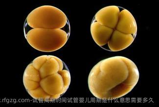 试管周期时间代孕周期是什么意思需要多久