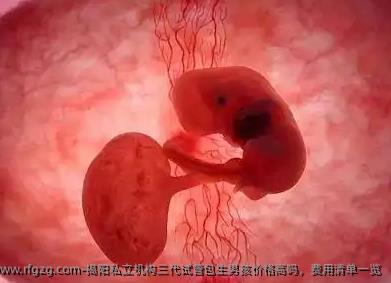 揭阳私立机构三代试管优生孩子孩价格高吗，费用清单一览