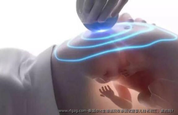 泰国dhc生殖医院在泰国代孕排名前三，真的吗？